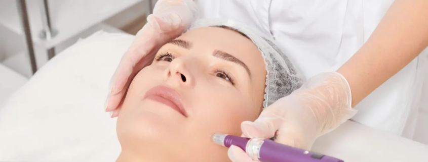 Microneedling