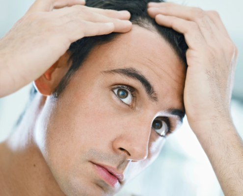 Discover effective tips and tricks on how to fix an uneven hairline.
