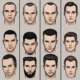 Types-Of-Hairline