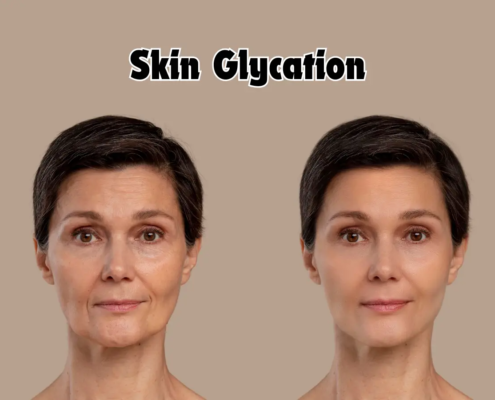 Skin Glycation