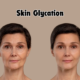 Skin Glycation