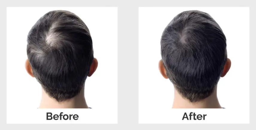 before-after-hair-treatment