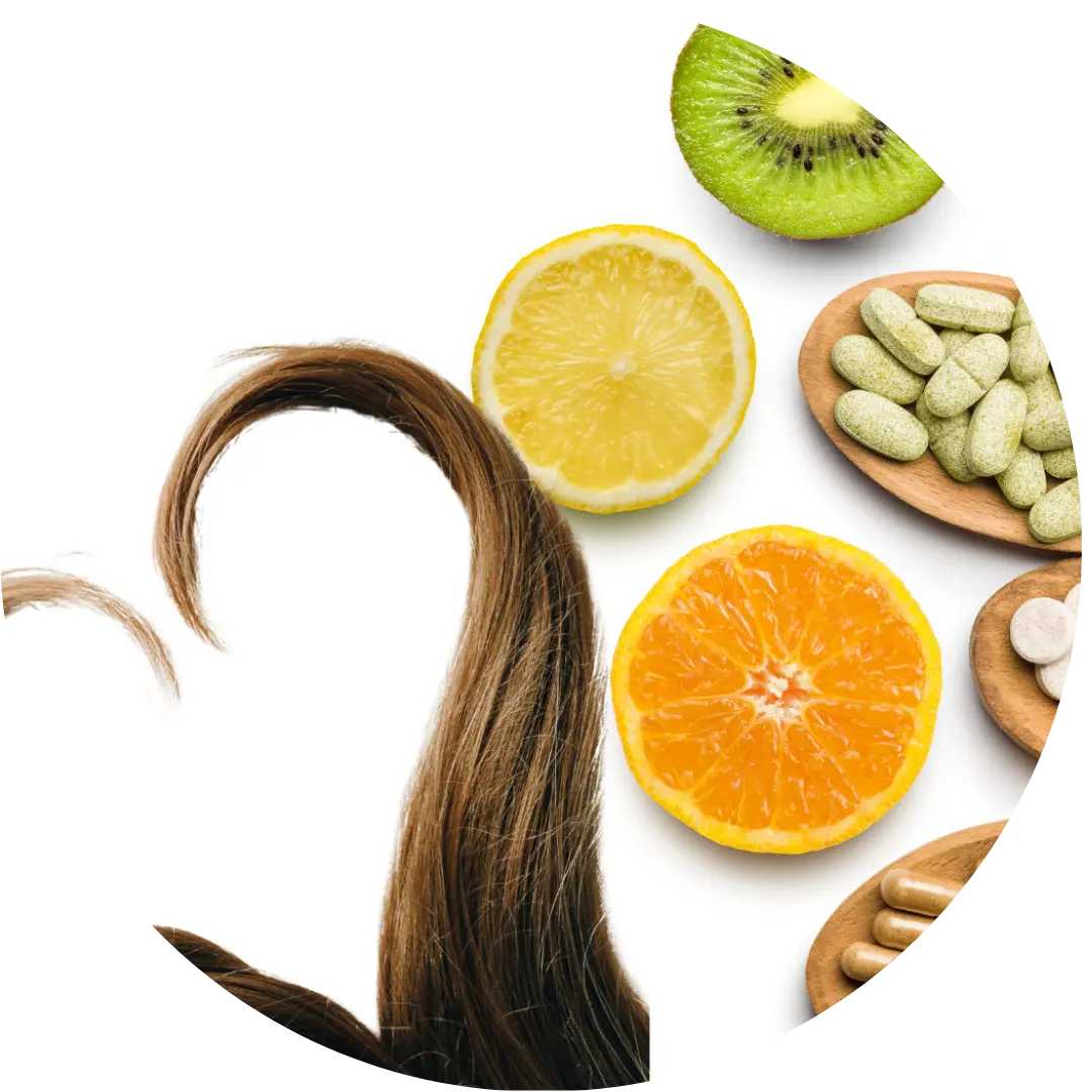 Vitamin-Hair-Loss